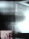 Outer Scan
