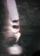 Outer Scan